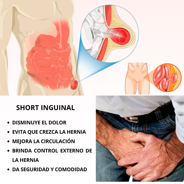 Short Inguinal